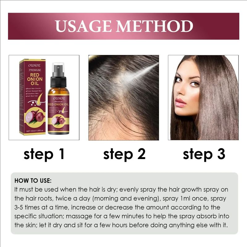 Hair Growth Serum Spray Prevent Hair Loss Scalp Treatment Improve Alopecia Strengthening Anti Dry Frizz Red Onion Essential Oil