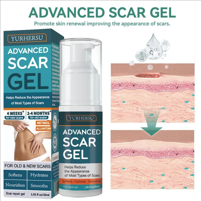 Advanced Recovery Scar Cream Fast Removal Skin Scars Treat Surgery Scars Stretch Marks Acne Pox Prints Burn Repair Gel