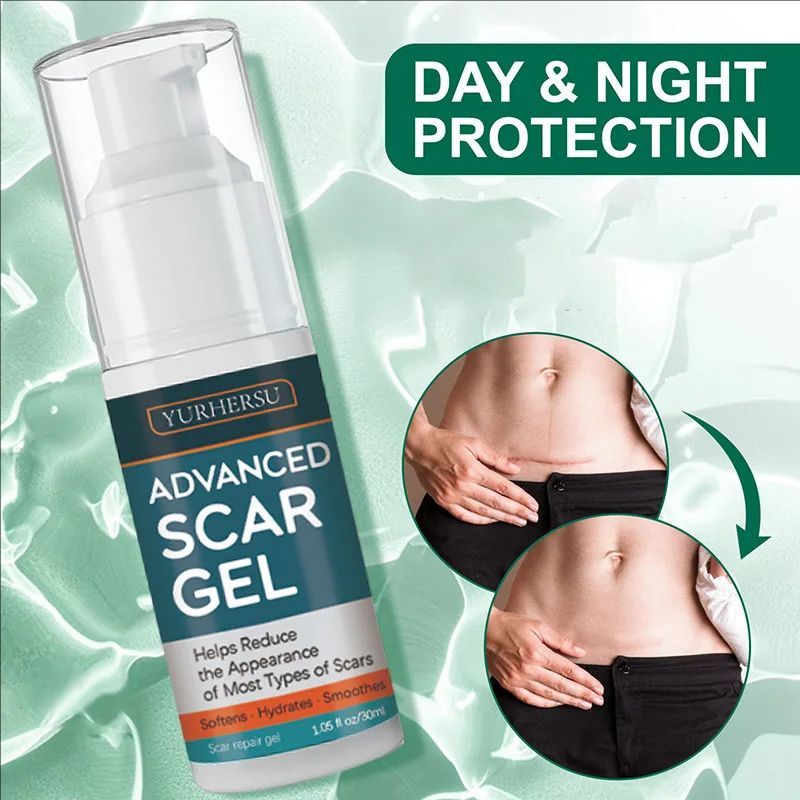 Advanced Recovery Scar Cream Fast Removal Skin Scars Treat Surgery Scars Stretch Marks Acne Pox Prints Burn Repair Gel