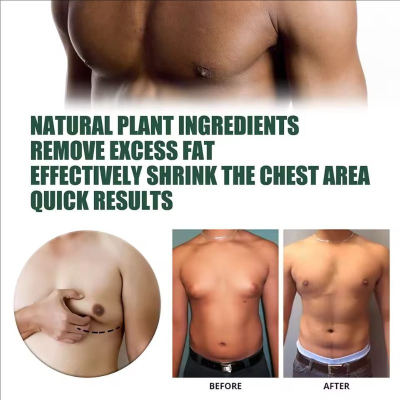 Man Breast Firm Massage Cream Ginger Serum Remove Excess Fat Effective Shrink Chest Gynecomastia Tighten Essence Oil Cream 30ml