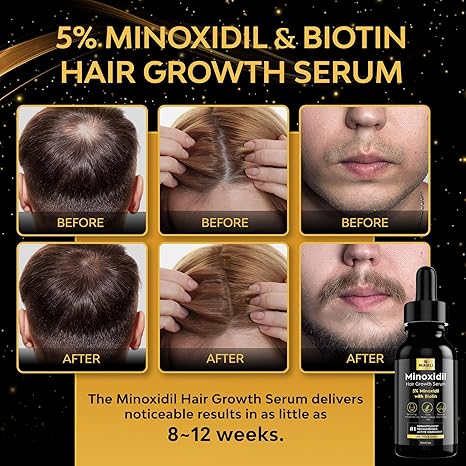 5% Minoxidil for Men & Women Hair Growth, Beard Growth, Hair Loss Treatment, Unisex Adult, Unscented Foam（60ML）