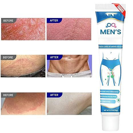 Chinese Herbal Relief Cream - Soothing and moisturizing, Rapid External Hemorrhoids Treat，For treatment of yeast infection, diabetes, allergy, other skin diseases, hormone changes and skin diseases