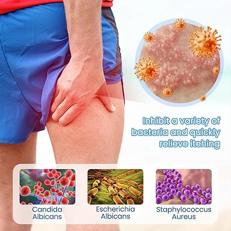 Chinese Herbal Relief Cream - Soothing and moisturizing, Rapid External Hemorrhoids Treat，For treatment of yeast infection, diabetes, allergy, other skin diseases, hormone changes and skin diseases