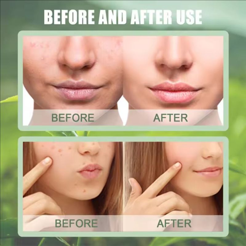 1PC Green Tea Mask Stick Purifying Clay Oil Control Cleansing Eggplant Stick Mask For Face Oil Control Anti-acne Whitening Hot