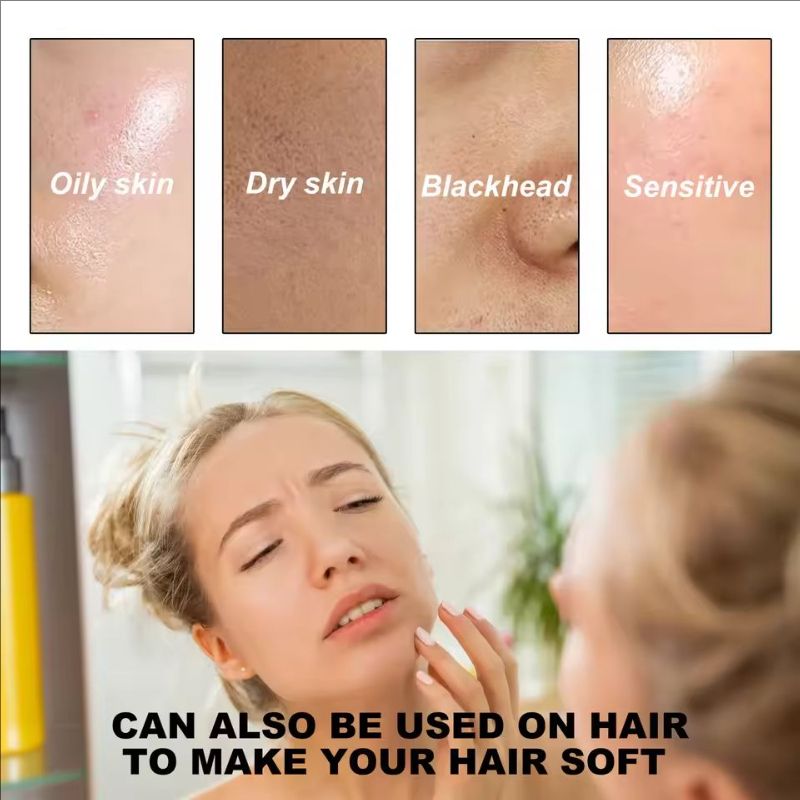 Moisturizing Aloe Vera Gel Acne Treatment Pimple Sp-ot Removal Oil Control Relieve Redness Repairing Wh-iten Soothing Skin Care