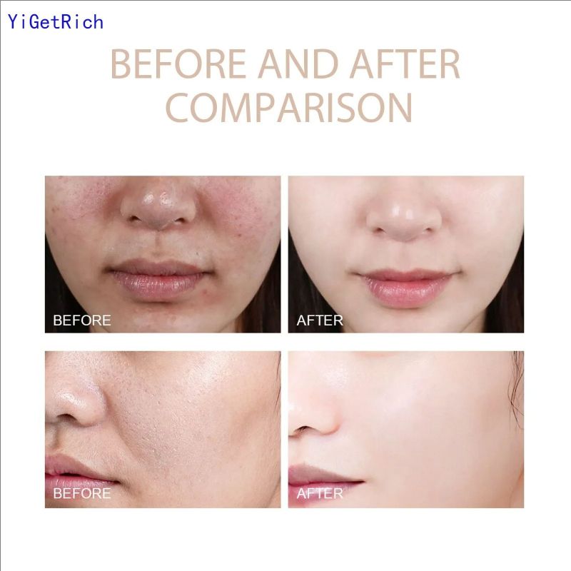 50g Purifying Exfoliating Gel Face And Body Exfoliating Scrub Gel For All Skin Purifying Cream,Purifying Gel Festival Gifts Yi
