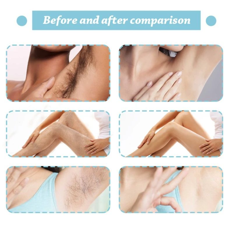 Fast Hair Removal Armpits Body Private Parts Moisture Gentle Non-irritating Painless Hair Removal Spray Permanent Depilatory
