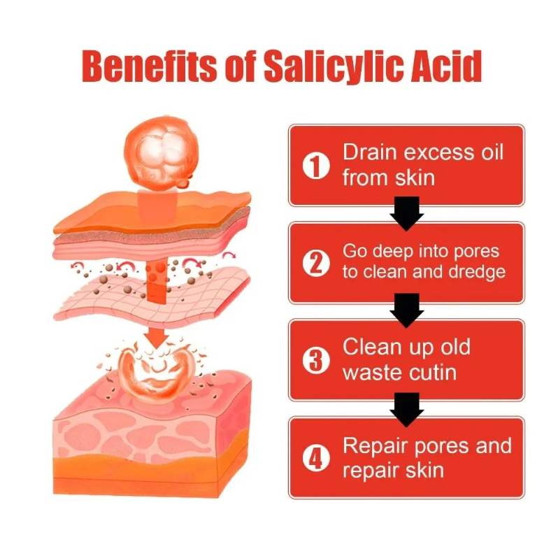 Niacinamida Whitening Face Serum Freckles Dark Spot Remover Salicylic Acid Pore Shrink Moisturizing Korean Skin Care Product