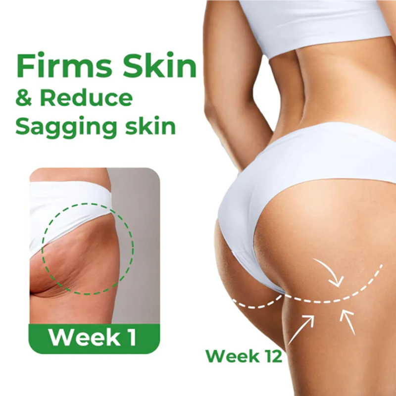 EELHOE Weight Loss Cream Slimming Belly Fat Burning Abdominal Fat Removal Tightening Body Shaping Anti Cellulite Massage Cream