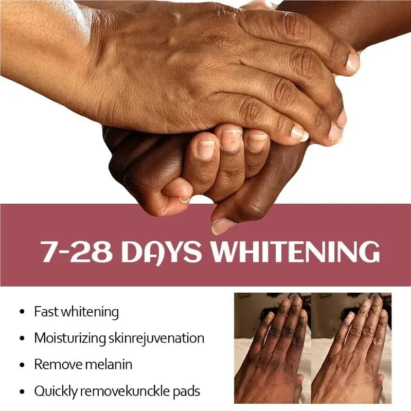 Fast Whitening Dark Knuckles Brighten Hand Cream Melanin Corrector Moisturizing Intense Stains Remover Cosmetics Skin Care 2024
