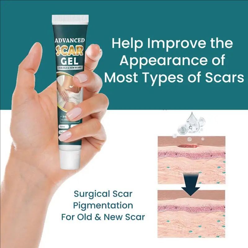 Scar Care Gel Repair Cream Scar Gel Scar Remover Natural Ointment Cuts Burns Skincare Scar Repair Stretch Mark Remover For Old