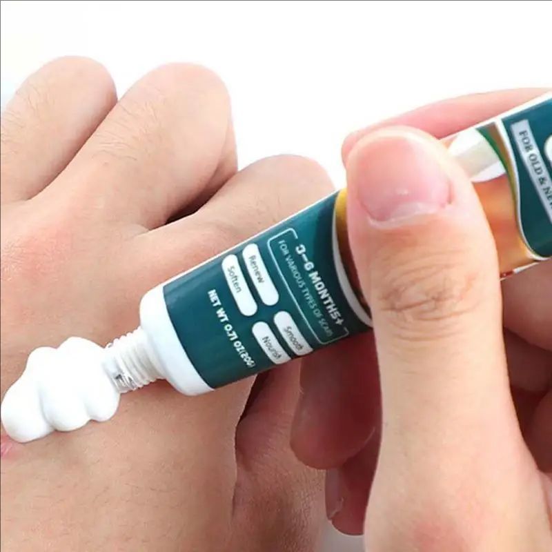 Scar Care Gel Repair Cream Scar Gel Scar Remover Natural Ointment Cuts Burns Skincare Scar Repair Stretch Mark Remover For Old