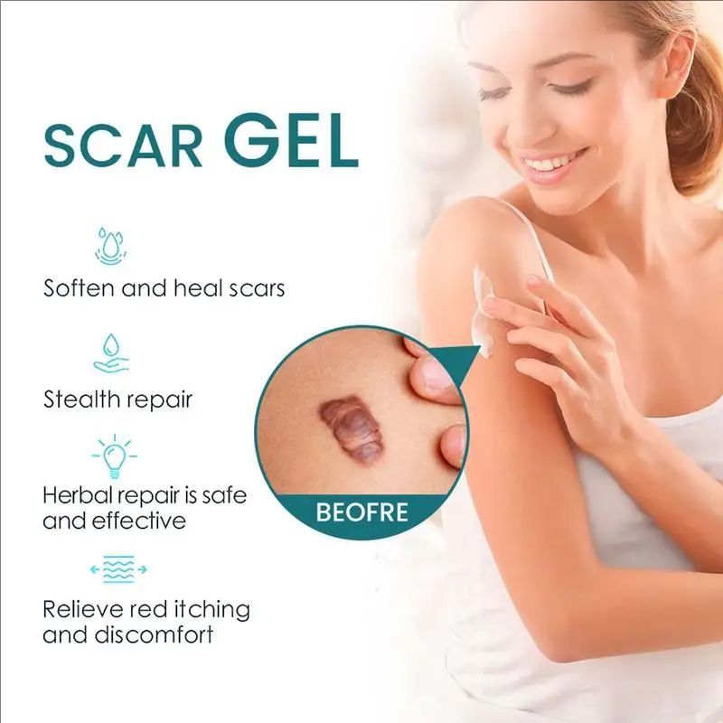 Scar Care Gel Repair Cream Scar Gel Scar Remover Natural Ointment Cuts Burns Skincare Scar Repair Stretch Mark Remover For Old