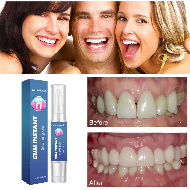 Gum Treatment Gel Relieve Gingival Atrophy Periodontitis Remove Tooth Plaque Stains Refresh Bad Breath Gum Recession Repair Gel