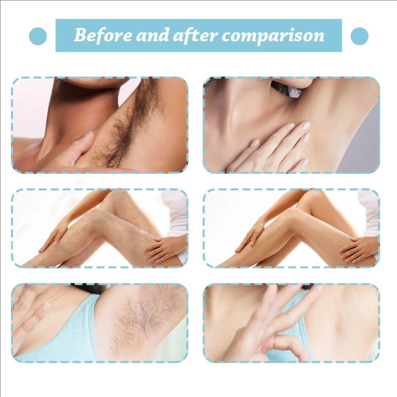 Permanent Hair Removal Spray Hair Growth Inhibitor Natural Painless Depilatory Cream Body Armpit Private Parts Hair Remover 20ml