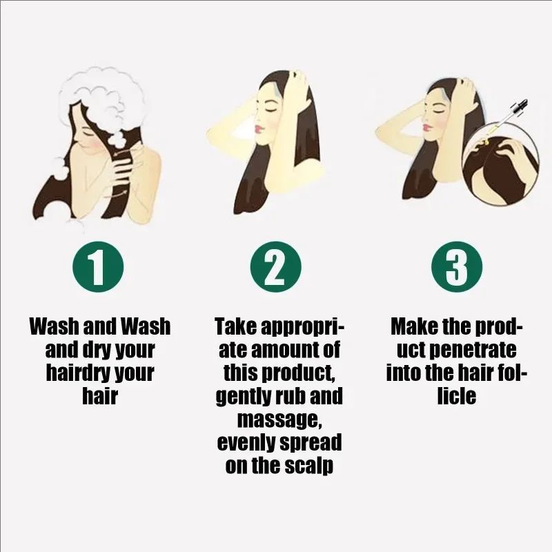Fast Hair Growth Anti Alopecia Oil Ginger Essential High Hairline Head Hair Serum Hairless Baldhead Increase Essence Cream