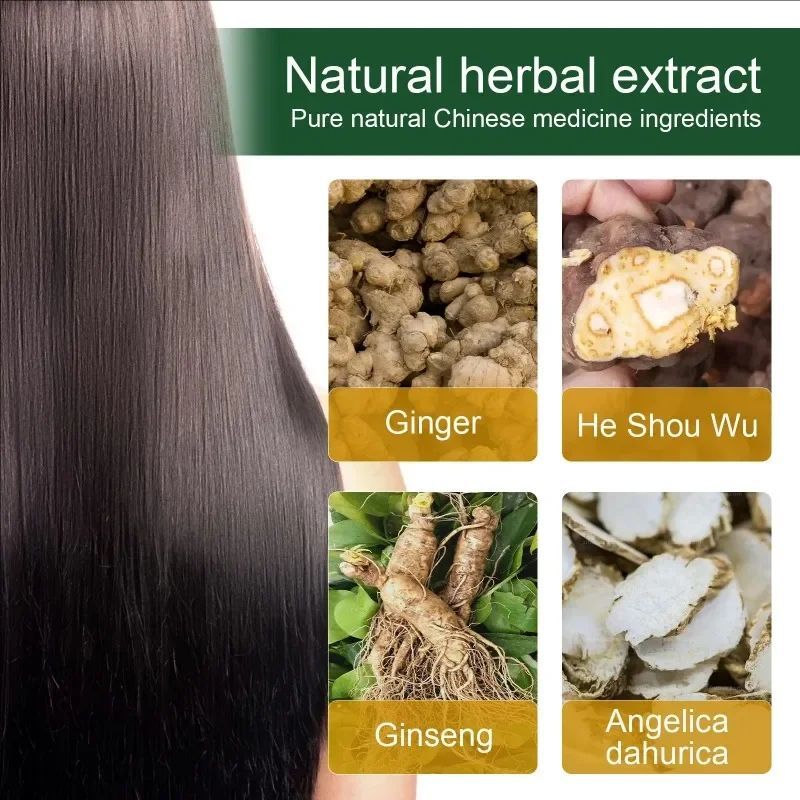 Fast Hair Growth Anti Alopecia Oil Ginger Essential High Hairline Head Hair Serum Hairless Baldhead Increase Essence Cream