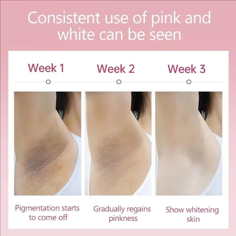 Inner Thigh Brighten Cream Bleaching Armpits Elbows Knees Moisturize Body Lotion Cream Brighten Lighten Whiten Melanin Skin Care