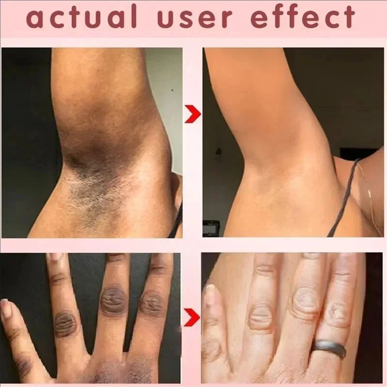 Inner Thigh Brighten Cream Bleaching Armpits Elbows Knees Moisturize Body Lotion Cream Brighten Lighten Whiten Melanin Skin Care