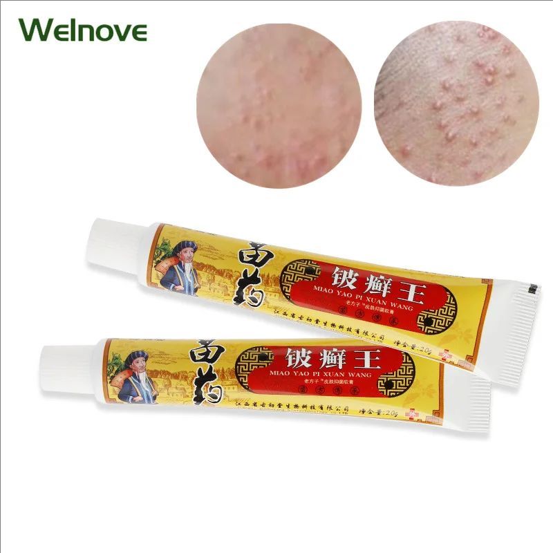 Herbal Psoriasis Treatment Cream Antibacterial Anti-itch Dermatiti Eczema Urticaria Alergy Skin Ointment Beauty Health Body Care