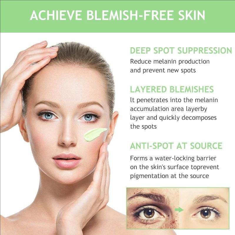 Whitening Freckles Cream Face Remove Melasma Dark Spots Lighter Melanin Melasma Remover Moisturizing Fleur Skin Care 30Ml