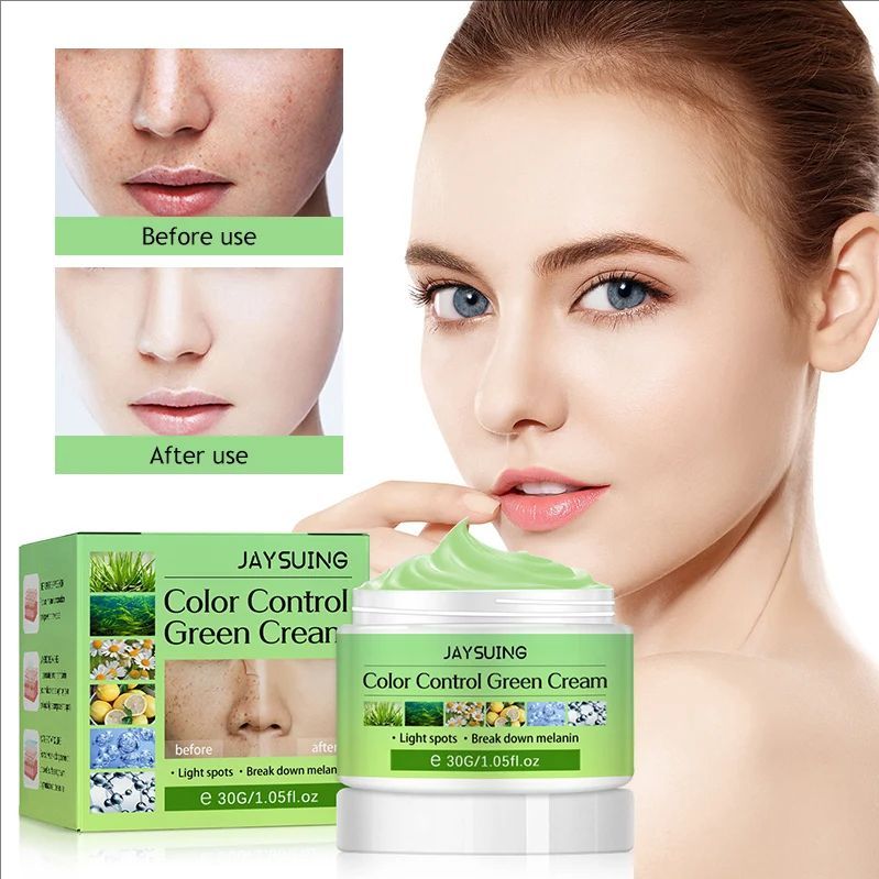 Whitening Freckles Cream Face Remove Melasma Dark Spots Lighter Melanin Melasma Remover Moisturizing Fleur Skin Care 30Ml