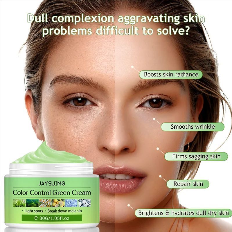 Whitening Freckles Cream Face Remove Melasma Dark Spots Lighter Melanin Melasma Remover Moisturizing Fleur Skin Care 30Ml
