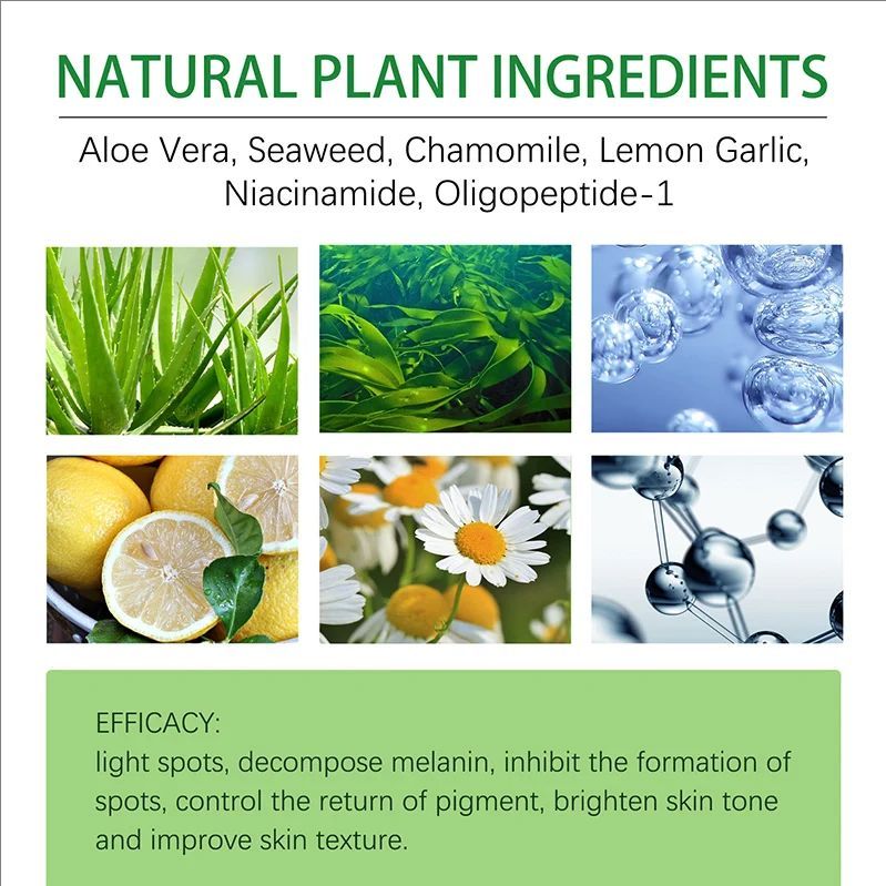 Whitening Freckles Cream Face Remove Melasma Dark Spots Lighter Melanin Melasma Remover Moisturizing Fleur Skin Care 30Ml