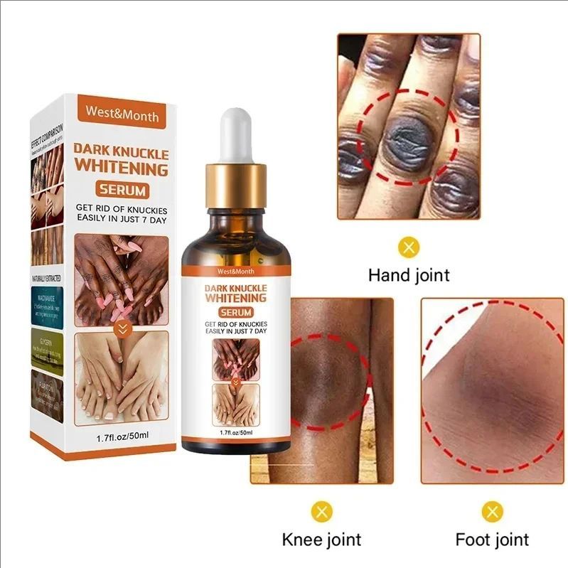 Dark Knuckles Whitening Serum Remover Get Rid Of Dark Knees Dark Knuckle Elbow Cream Nicotinamide Brighten Skin Tone Care