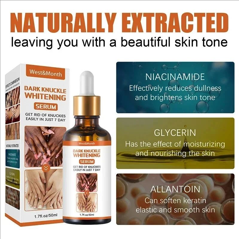 Dark Knuckles Whitening Serum Remover Get Rid Of Dark Knees Dark Knuckle Elbow Cream Nicotinamide Brighten Skin Tone Care