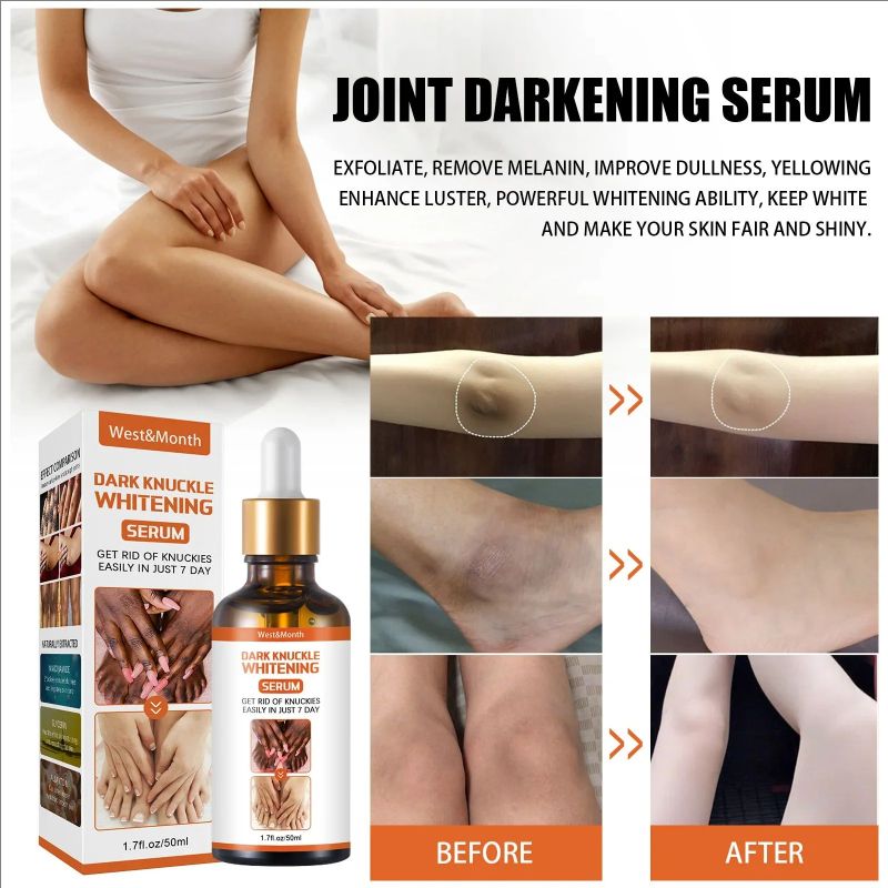 Dark Knuckles Whitening Serum Remover Get Rid Of Dark Knees Dark Knuckle Elbow Cream Nicotinamide Brighten Skin Tone Care