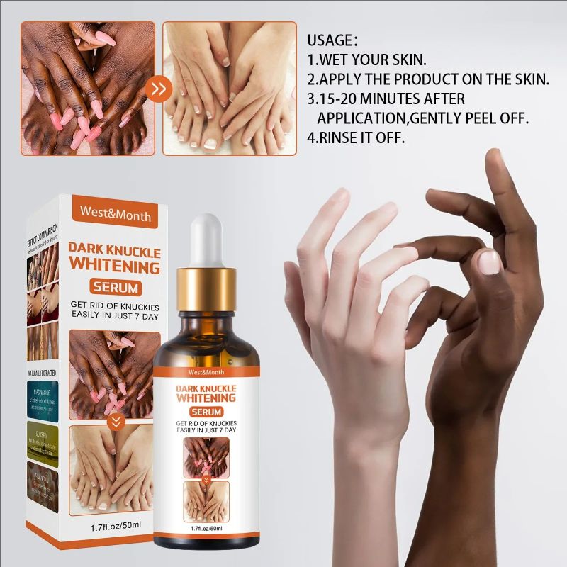 Dark Knuckles Whitening Serum Remover Get Rid Of Dark Knees Dark Knuckle Elbow Cream Nicotinamide Brighten Skin Tone Care