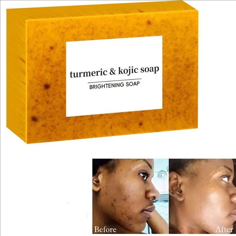 Turmeric Kojic Acid Glow Soap Dark Spot Acne Removal Even Skin Tone Mositen Smooth Skin Deep Cleansing Handmade Soap