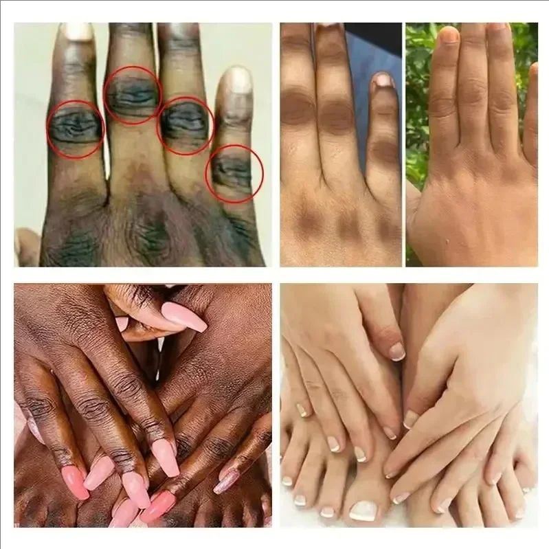 Dark Knuckles Fast Brightening Serum Hand Anti Cracking Cream Fingers Brighten Moisturiz For Dark Skin Stains Remover Products