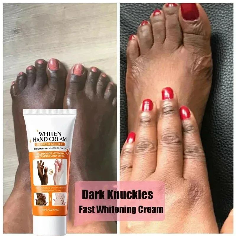 Dark Knuckles Fast Brightening Serum Hand Anti Cracking Cream Fingers Brighten Moisturiz For Dark Skin Stains Remover Products