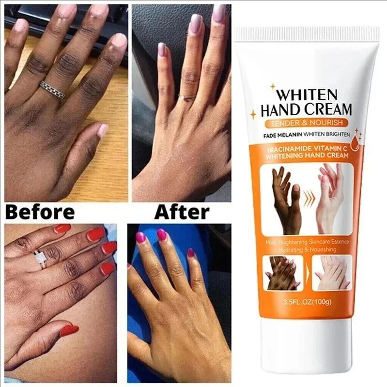 Dark Knuckles Fast Brightening Serum Hand Anti Cracking Cream Fingers Brighten Moisturiz For Dark Skin Stains Remover Products
