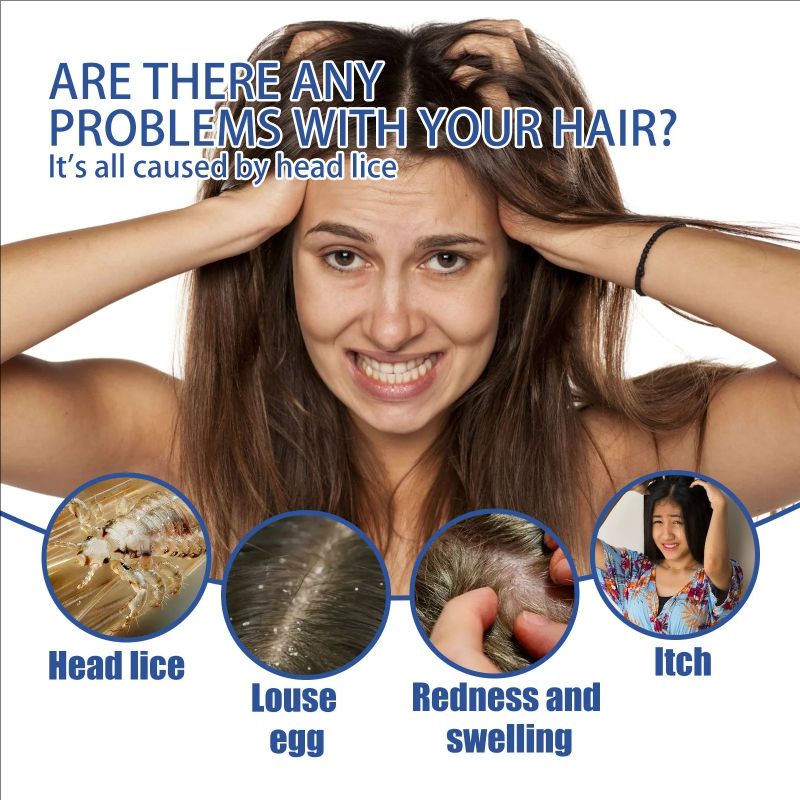 South Moon Head lice removal spray for children, adults and girls Head lice removal spray for lice removal spray