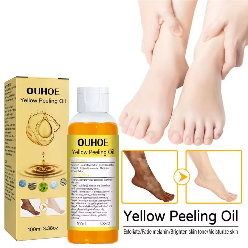 Natural Yellow Peeling Oil Extra Strong Whitening Exfoliating Bleaching Dark Skin Hands Feet Body Care Solution for All Skin