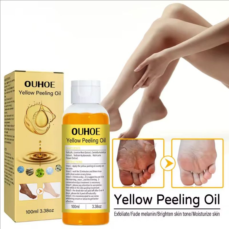 Natural Yellow Peeling Oil Extra Strong Whitening Exfoliating Bleaching Dark Skin Hands Feet Body Care Solution for All Skin
