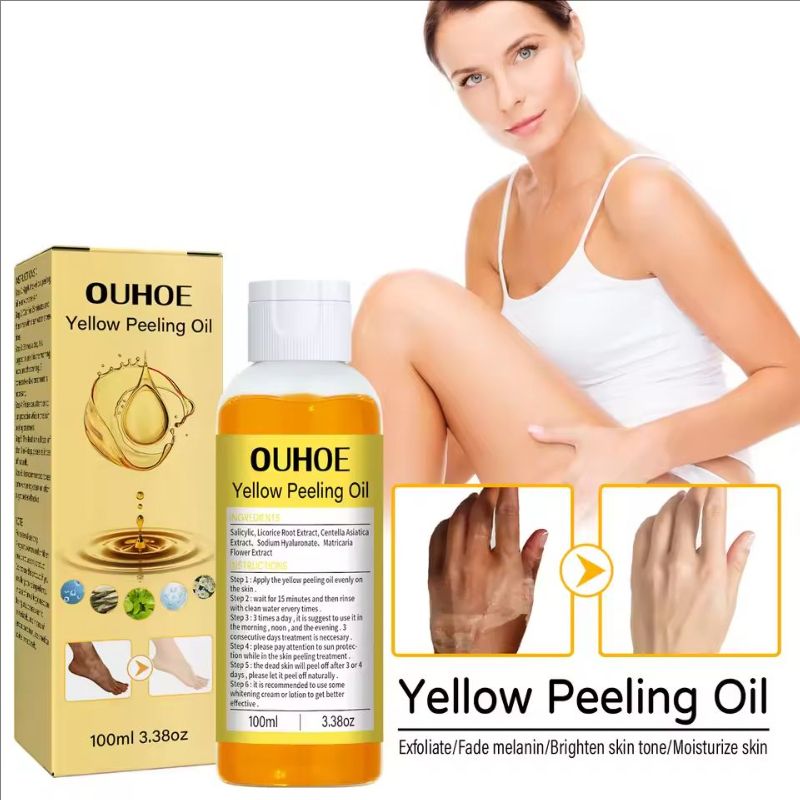 Natural Yellow Peeling Oil Extra Strong Whitening Exfoliating Bleaching Dark Skin Hands Feet Body Care Solution for All Skin