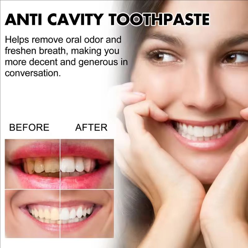 Oralhoe 30g Anti Cavity Toothpaste Whiten Teeth Repair Decay Relieve Periodontitis Fresh Breath Oral Care Anti Yellow Toothpaste