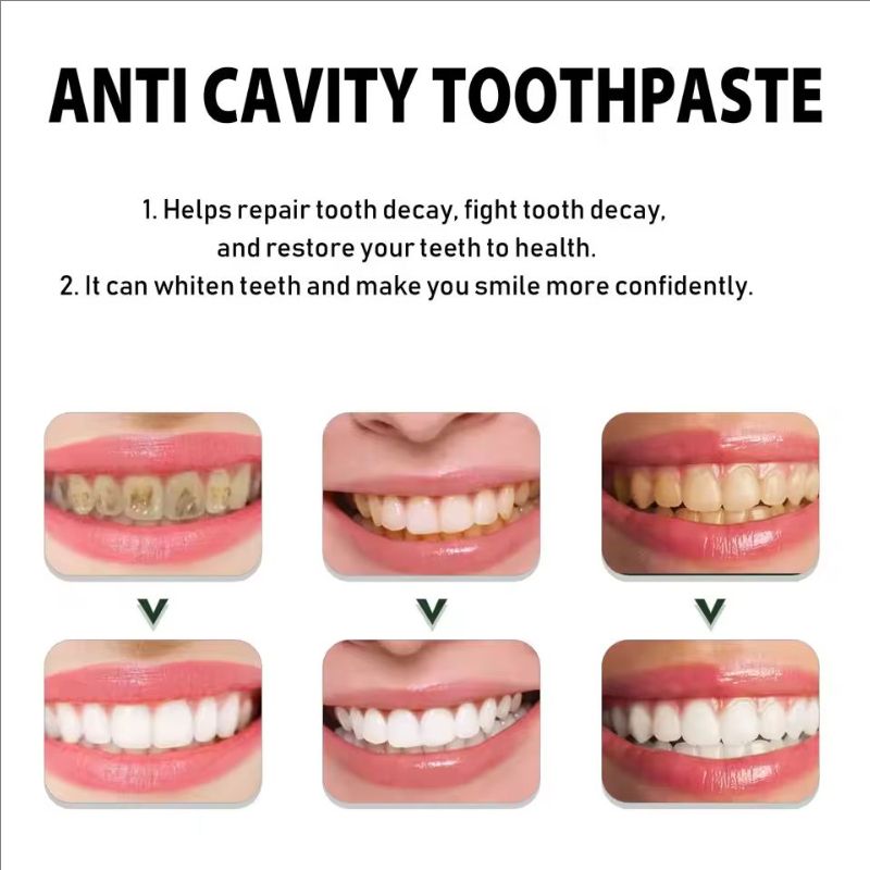 Oralhoe 30g Anti Cavity Toothpaste Whiten Teeth Repair Decay Relieve Periodontitis Fresh Breath Oral Care Anti Yellow Toothpaste