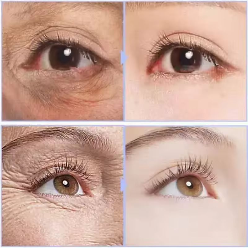 Instant Eye Cream For Anti Aging Dark Circles Bags Puffiness Great Under Eye Skin Face Tightening Eye Lift Treatment Care