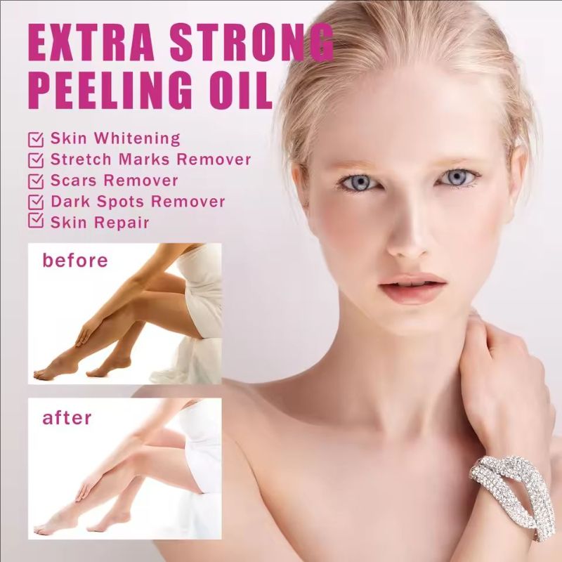 Exfoliating Peeling Oil Legs Elbow Joint Hand Dark Skin Bleaching Beautiful Delicate SkinMoisturizer Whitening Spots Oil