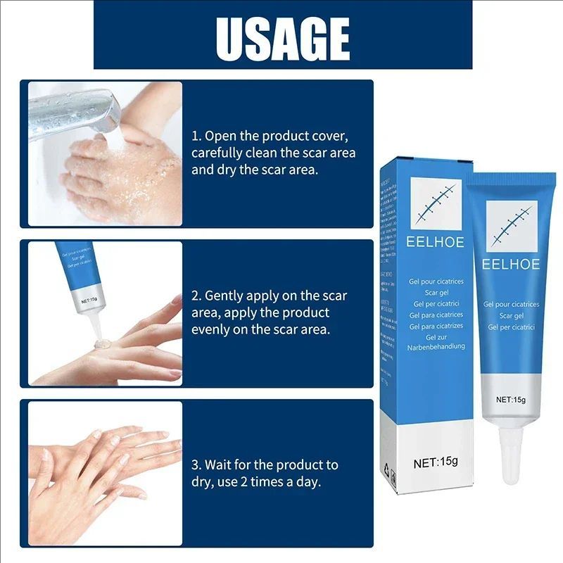 High Effect Laser Pen Therapy Keloid Scar Repair Cream Reduces Hyperplasia Pregnancy Surgery Burn Scar Skin Repair Cream