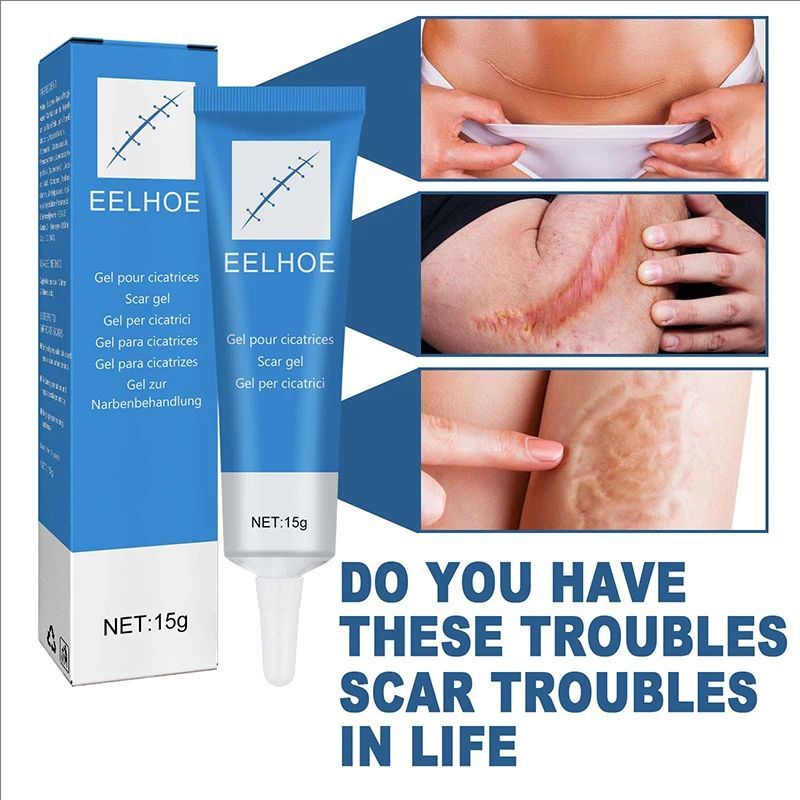 High Effect Laser Pen Therapy Keloid Scar Repair Cream Reduces Hyperplasia Pregnancy Surgery Burn Scar Skin Repair Cream