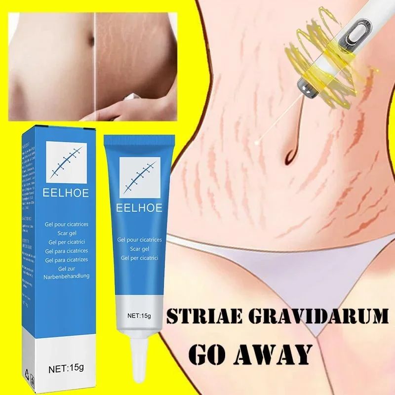 High Effect Laser Pen Therapy Keloid Scar Repair Cream Reduces Hyperplasia Pregnancy Surgery Burn Scar Skin Repair Cream