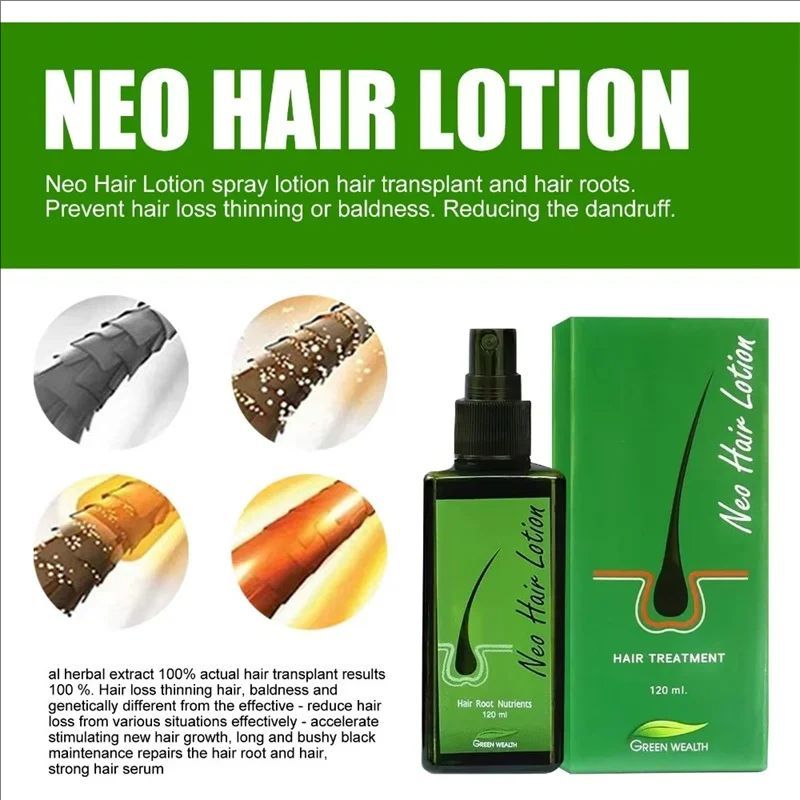 Hair Care Lotion 120 ml Hair Regrowth Treatment Growth Strengthens Damaged Hair Loss Revitalizes Scalp For Men & Women