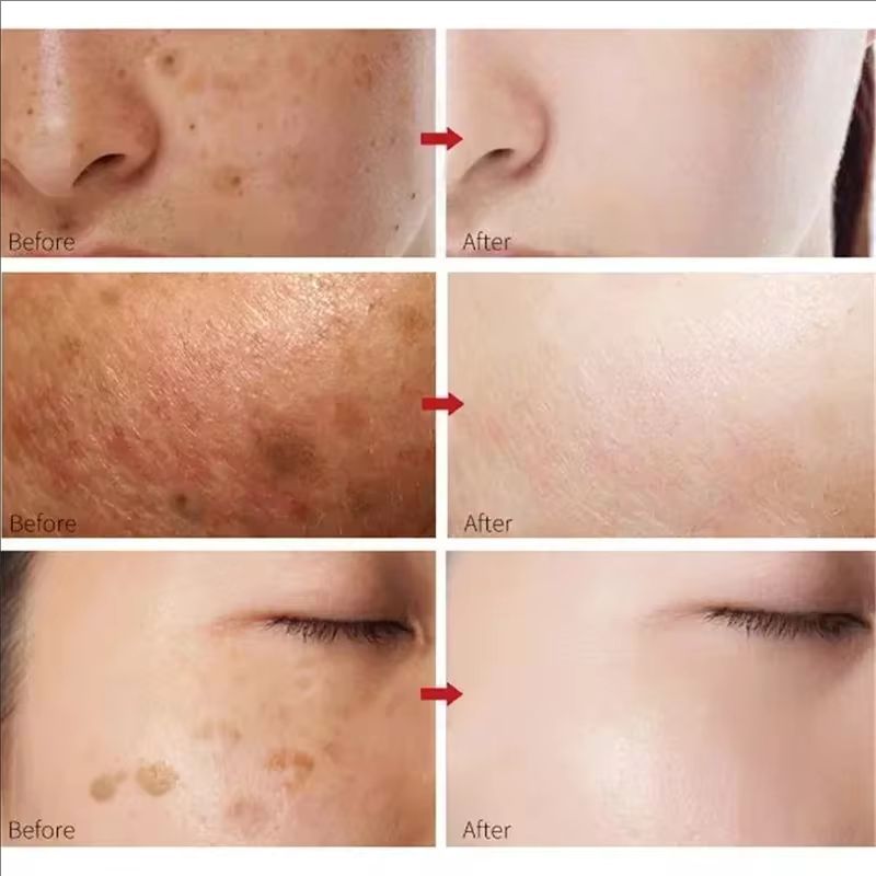 White Rice Face Whitening Cream Remove Dark Spots Fade Freckle Melanin Anti Wrinkle Aging Moisturizing Brighten Skin Care New