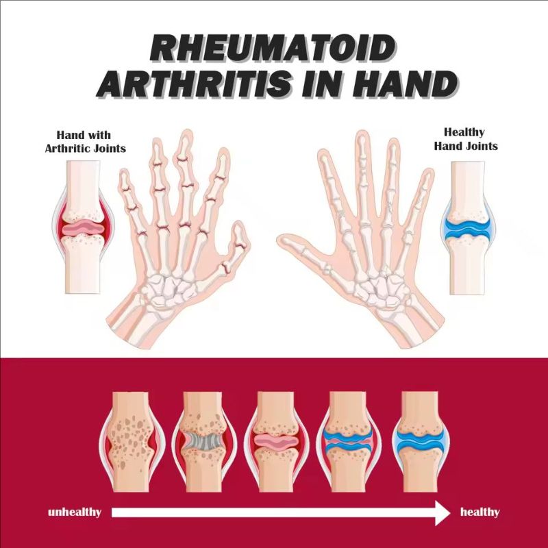 Soothing Joint Bone Soreness, Deformation Correction and Repair, Joint Bone Collagen Cream